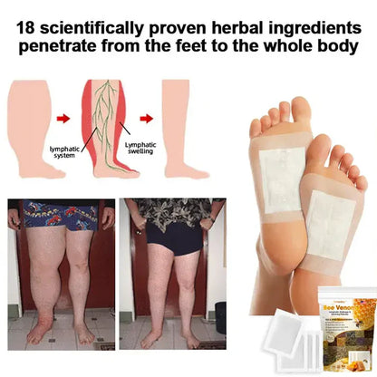 Original Bee Venom Foot Patch II Detox Patches 🌿👣(Set of 10+10) - Buy 10 Get 10 Free